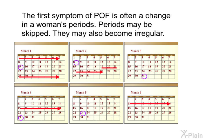 The first symptom of POF is often a change in a woman's periods. Periods may be skipped. They may also become irregular.