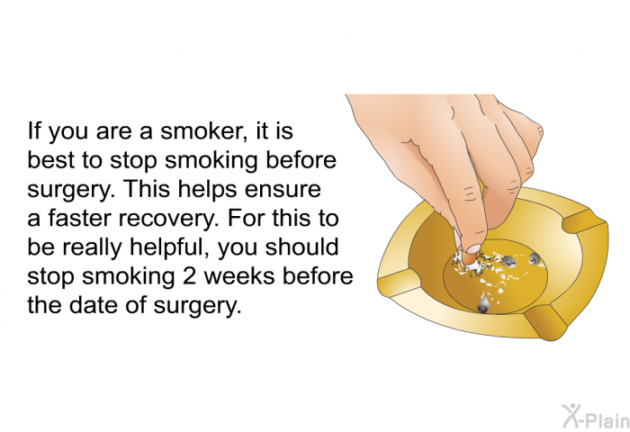 If you are a smoker, it is best to stop smoking before surgery. This helps ensure a faster recovery. For this to be really helpful, you should stop smoking 2 weeks before the date of surgery.