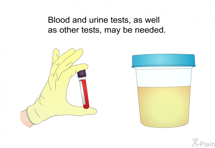 Blood and urine tests, as well as other tests, may be needed.