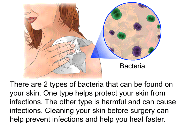 There are 2 types of bacteria that can be found on your skin. One type helps protect your skin from infections. The other type is harmful and can cause infections. Cleaning your skin before surgery can help prevent infections and help you heal faster.