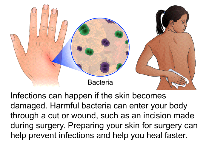 Infections can happen if the skin becomes damaged. Harmful bacteria can enter your body through a cut or wound, such as an incision made during surgery. Preparing your skin for surgery can help prevent infections and help you heal faster.