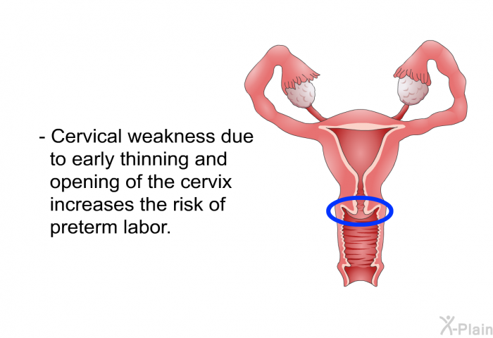 Cervical weakness due to early thinning and opening of the cervix increases the risk of preterm labor.