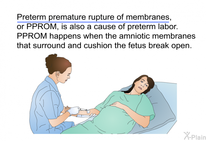 Preterm premature rupture of membranes, or PPROM, is also a cause of preterm labor. PPROM happens when the amniotic membranes that surround and cushion the fetus break open.