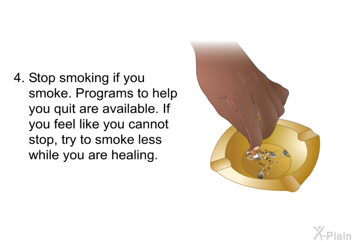 Stop smoking if you smoke. Programs to help you quit are available. If you feel like you cannot stop, try to smoke less while you are healing.