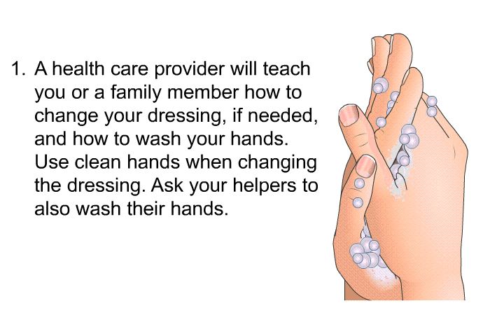 A health care provider will teach you or a family member how to change your dressing, if needed, and how to wash your hands. Use clean hands when changing the dressing. Ask your helpers to also wash their hands.