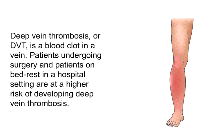 Deep vein thrombosis, or DVT, is a blood clot in a vein. Patients undergoing surgery and patients on bed-rest in a hospital setting are at a higher risk of developing deep vein thrombosis.