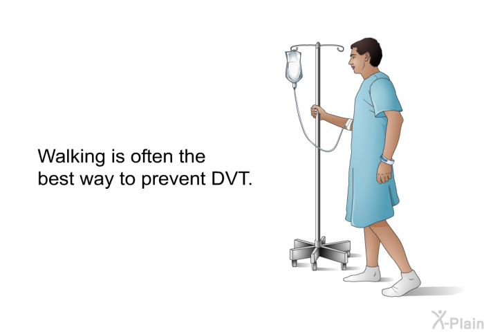 Walking is often the best way to prevent DVT.