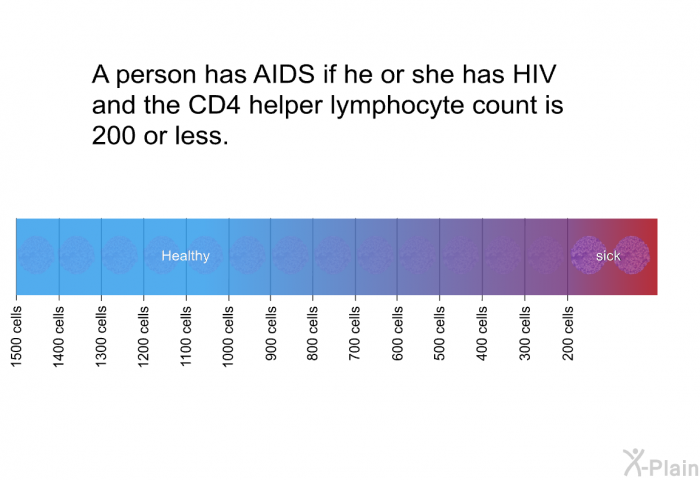 A person has AIDS if he or she has HIV and the CD4 helper lymphocyte count is 200 or less.