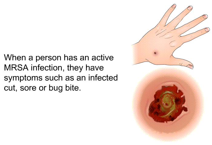 When a person has an active MRSA infection, they have symptoms such as an infected cut, sore or bug bite.
