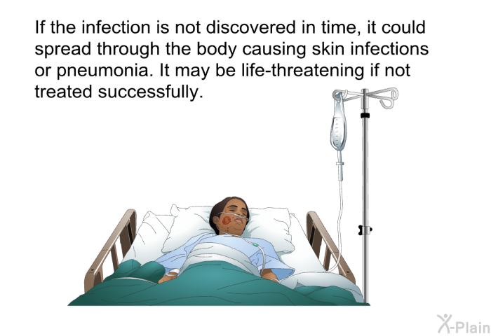 If the infection is not discovered in time, it could spread through the body causing skin infections or pneumonia. It may be life-threatening if not treated successfully.