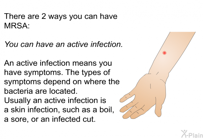 There are 2 ways you can have MRSA: 
You can have an active infection. 
An active infection means you have symptoms. The types of symptoms depend on where the bacteria are located. Usually an active infection is a skin infection, such as a boil, a sore, or an infected cut.