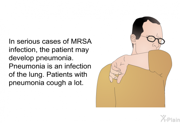 In serious cases of MRSA infection, the patient may develop pneumonia. Pneumonia is an infection of the lung. Patients with pneumonia cough a lot.