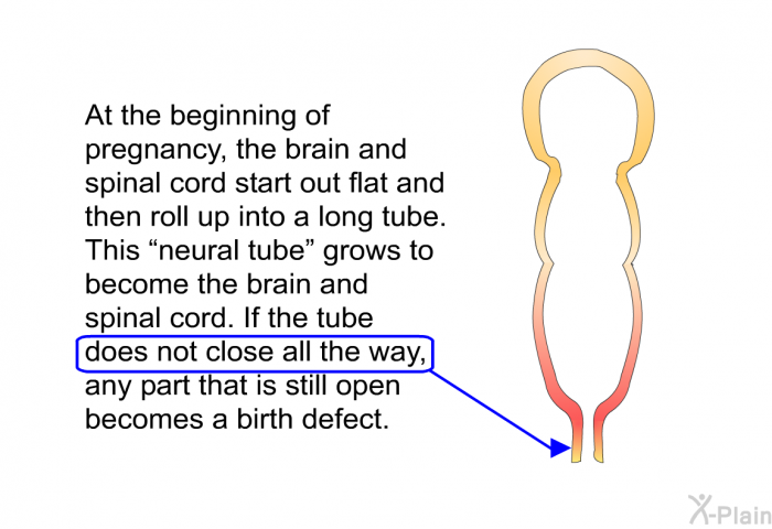 At the beginning of pregnancy, the brain and spinal cord start out flat and then roll up into a long tube. This “neural tube” grows to become the brain and spinal cord. If the tube does not close all the way, any part that is still open becomes a birth defect.