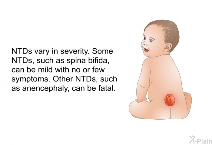 NTDs vary in severity. Some NTDs, such as spina bifida, can be mild with no or few symptoms. Other NTDs, such as anencephaly, can be fatal.