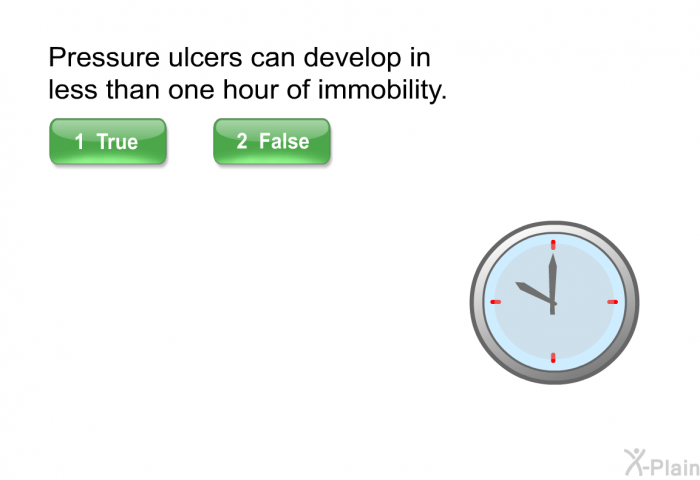 Pressure ulcers can develop in less than one hour of immobility. Press True or False
