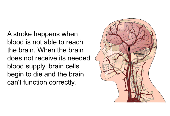 A stroke happens when blood is not able to reach the brain. When the brain does not receive its needed blood supply, brain cells begin to die and the brain can't function correctly.
