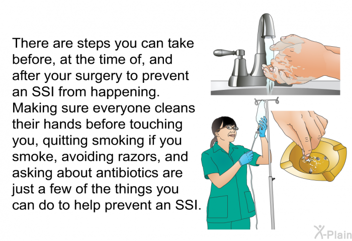 There are steps you can take before, at the time of, and after your surgery to prevent an SSI from happening. Making sure everyone cleans their hands before touching you, quitting smoking if you smoke, avoiding razors, and asking about antibiotics are just a few of the things you can do to help prevent an SSI.