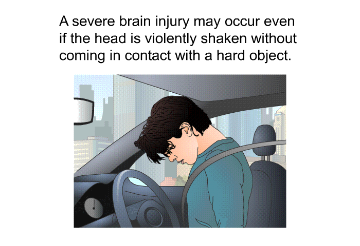 A severe brain injury may occur even if the head is violently shaken without coming in contact with a hard object.