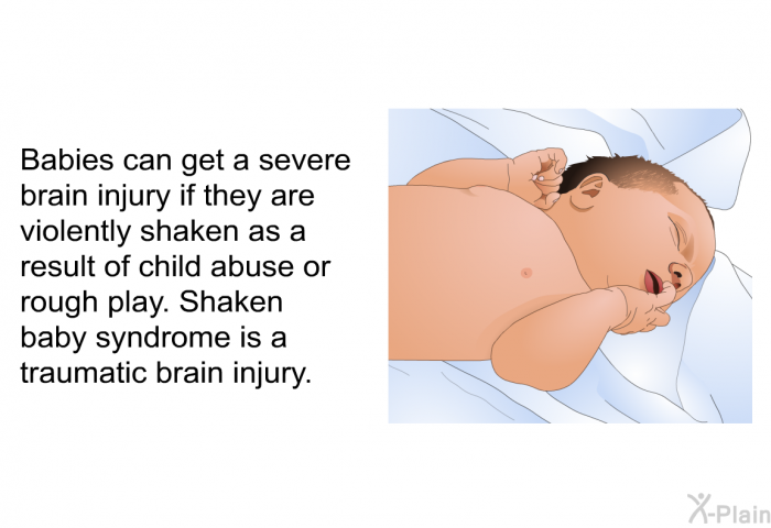 Babies can get a severe brain injury if they are violently shaken as a result of child abuse or rough play. Shaken baby syndrome is a traumatic brain injury.