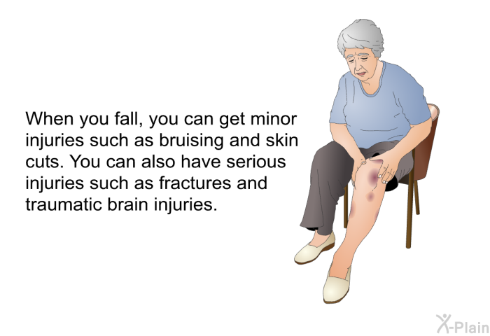 When you fall, you can get minor injuries such as bruising and skin cuts. You can also have serious injuries such as fractures and traumatic brain injuries.