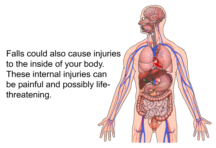 Falls could also cause injuries to the inside of your body. These internal injuries can be painful and possibly life-threatening.