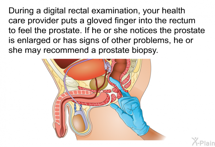 During a digital rectal examination, your health care provider puts a gloved finger into the rectum to feel the prostate. If he or she notices the prostate is enlarged or has signs of other problems, he or she may recommend a prostate biopsy.