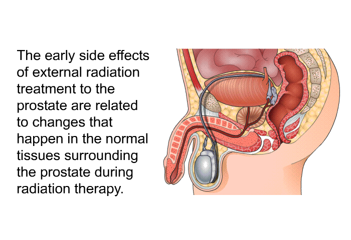 The early side effects of external radiation treatment to the prostate are related to changes that happen in the normal tissues surrounding the prostate during radiation therapy.