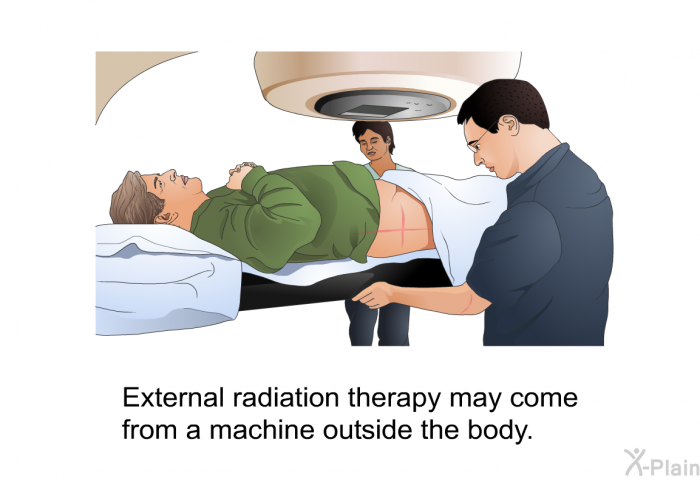 External radiation therapy may come from a machine outside the body.