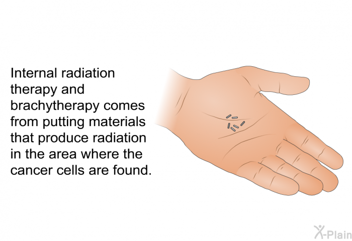 Internal radiation therapy and brachytherapy comes from putting materials that produce radiation in the area where the cancer cells are found.