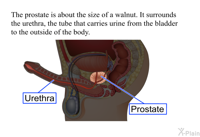 The prostate is about the size of a walnut. It surrounds the urethra, the tube that carries urine from the bladder to the outside of the body.