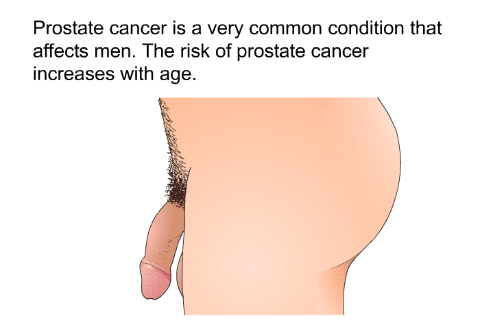 Prostate cancer is a very common condition that affects men. The risk of prostate cancer increases with age.