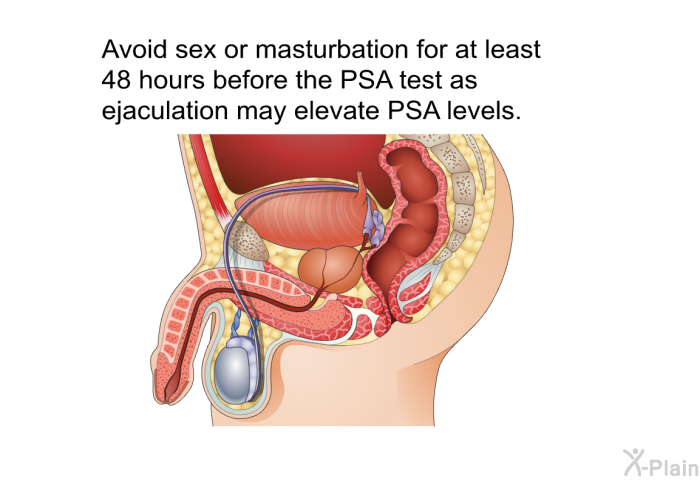 Avoid sex or masturbation for at least 48 hours before the PSA test as ejaculation may elevate PSA levels.