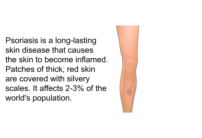 Psoriasis is a long-lasting skin disease that causes the skin to become inflamed. Patches of thick, red skin are covered with silvery scales. It affects 2-3% of the world's population.
