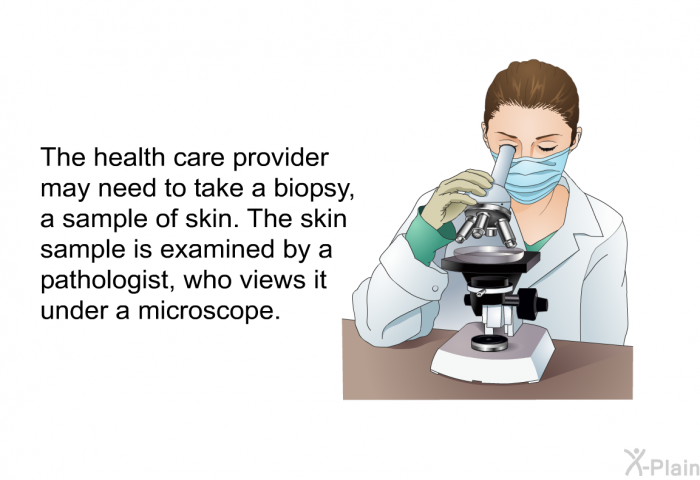 The health care provider may need to take a biopsy, a sample of skin. The skin sample is examined by a pathologist, who views it under a microscope.