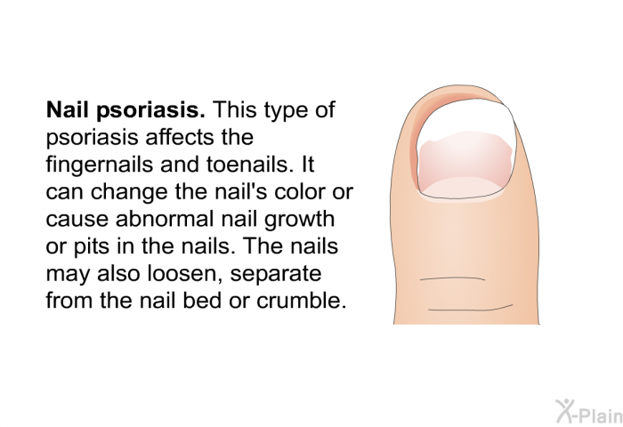 <I><B>Nail psoriasis</B></I>. This type of psoriasis affects the fingernails and toenails. It can change the nail's color or cause abnormal nail growth or pits in the nails. The nails may also loosen, separate from the nail bed or crumble.
