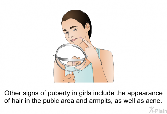 Other signs of puberty in girls include the appearance of hair in the pubic area and armpits, as well as acne.