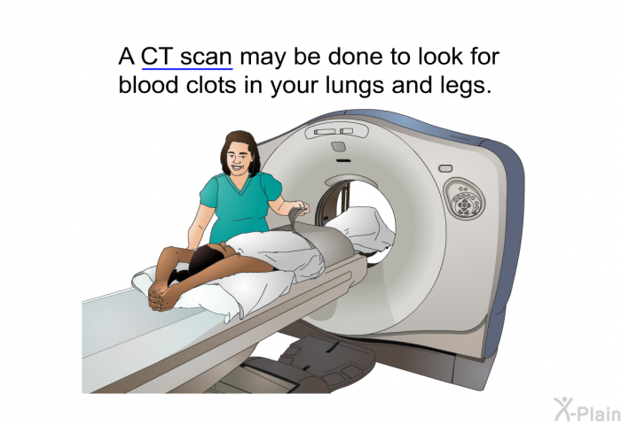 A CT scan may be done to look for blood clots in your lungs and legs.