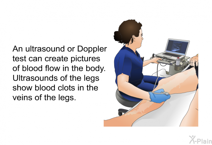 An ultrasound or Doppler test can create pictures of blood flow in the body. Ultrasounds of the legs show blood clots in the veins of the legs.