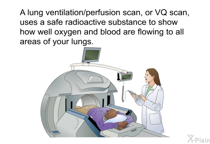A lung ventilation/perfusion scan, or VQ scan, uses a safe radioactive substance to show how well oxygen and blood are flowing to all areas of your lungs.