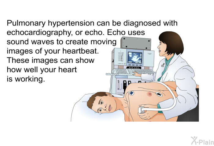 Pulmonary hypertension can be diagnosed with echocardiography, or echo. Echo uses sound waves to create moving images of your heartbeat. These images can show how well your heart is working.