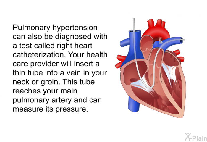 Pulmonary hypertension can also be diagnosed with a test called right heart catheterization. Your health care provider will insert a thin tube into a vein in your neck or groin. This tube reaches your main pulmonary artery and can measure its pressure.
