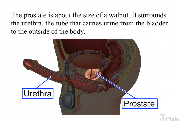 The prostate is about the size of a walnut. It surrounds the urethra, the tube that carries urine from the bladder to the outside of the body.