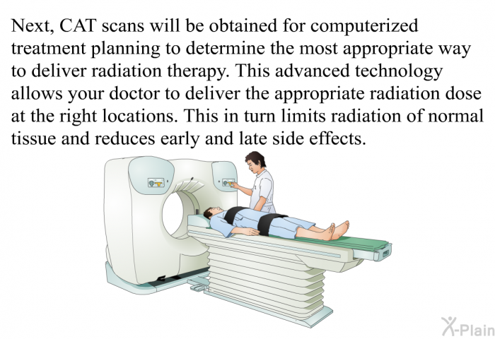Next, CAT scans will be obtained for computerized treatment planning to determine the most appropriate way to deliver radiation therapy. This advanced technology allows your doctor to deliver the appropriate radiation dose at the right locations. This in turn limits radiation of normal tissue and reduces early and late side effects.