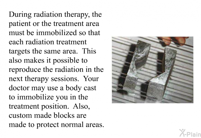 During radiation therapy, the patient or the treatment area must be immobilized so that each radiation treatment targets the same area. This also makes it possible to reproduce the radiation in the next therapy sessions. Your doctor may use a body cast to immobilize you in the treatment position. Also, custom made blocks are made to protect normal areas.