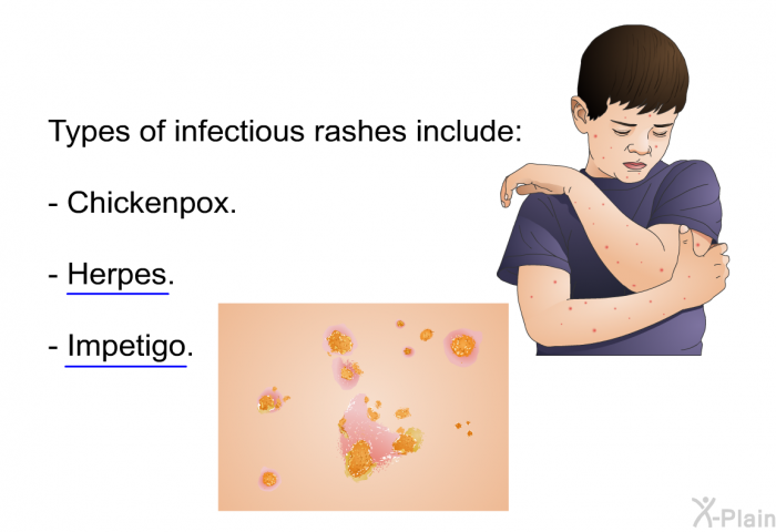 Types of infectious rashes include:  Chickenpox. Herpes. Impetigo.