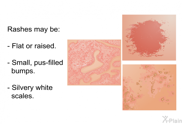 Rashes may be:  Flat or raised. Small, pus-filled bumps. Silvery white scales.