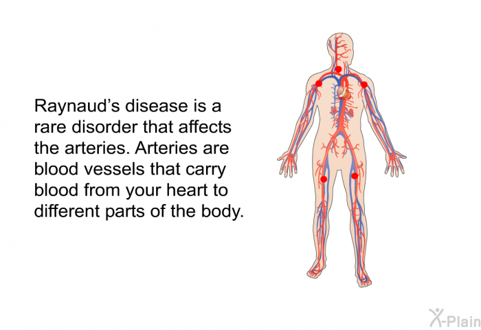 Raynaud's disease is a rare disorder that affects the arteries. Arteries are blood vessels that carry blood from your heart to different parts of the body.