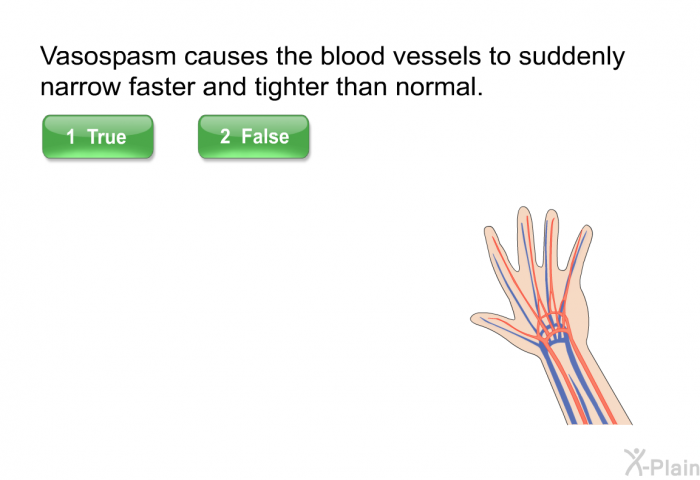 Vasospasm causes the blood vessels to suddenly narrow faster and tighter than normal. Select True or False.