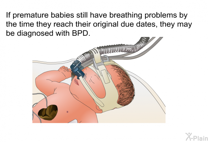 If premature babies still have breathing problems by the time they reach their original due dates, they may be diagnosed with BPD.