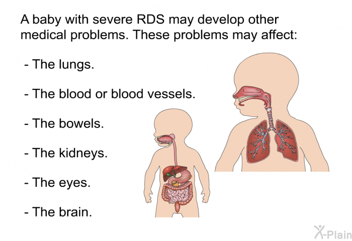 A baby with severe RDS may develop other medical problems. These problems may affect:  The lungs. The blood or blood vessels. The bowels. The kidneys. The eyes. The brain.